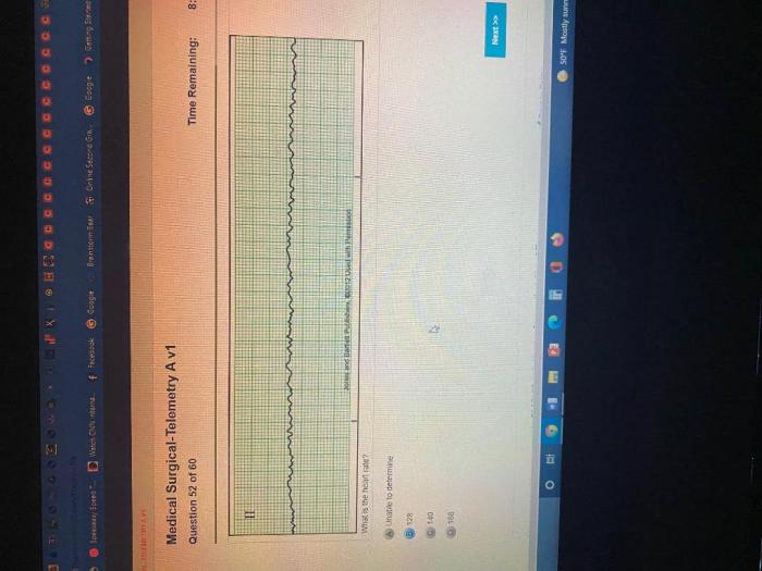 Medical surgical telemetry a relias